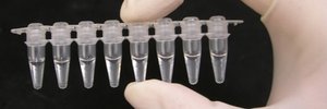 Cost is a significant hurdle to ending the rape kit backlog